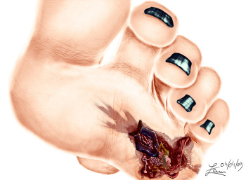 Artist - Nymmaz cover